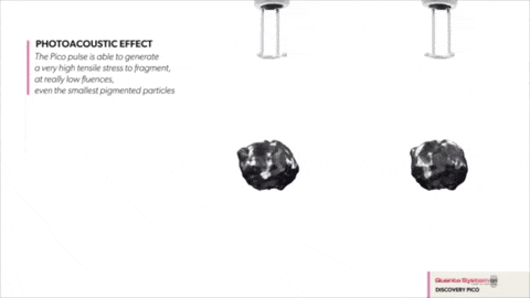 pico-vs-q-switched-animation