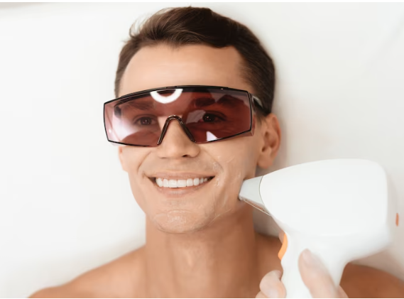 Men remove facial hair by laser